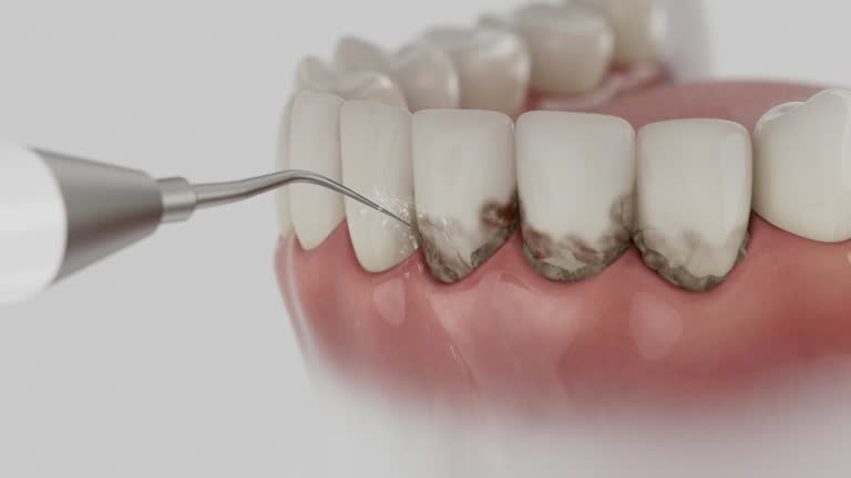 Reliable Dental Implants contractor in Hoopa, CA by Smile Center Dentistry
